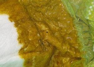 宝宝吃绿色瓜大便颜色,揭秘大便颜色变化之谜